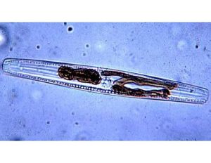 狹軸舟形藻 狹軸舟形藻