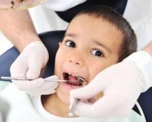 牙齒蛀牙 牙齒蛀牙