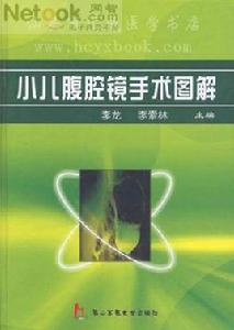 小兒腹腔鏡手術圖解 小兒腹腔鏡手術圖解