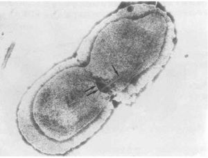 類志賀毗鄰單胞菌 類志賀毗鄰單胞菌
