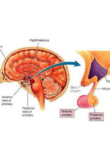 卡爾曼氏綜合症 卡爾曼氏綜合症