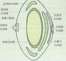 超聲乳化白內障吸除術