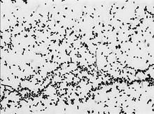 克呂沃爾氏菌屬 克呂沃爾氏菌屬