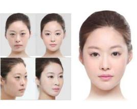 雷射去眼袋 雷射去眼袋