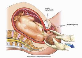 母體產道 母體產道