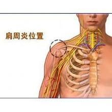 濟愈堂肩周健骨舒絡貼 濟愈堂肩周健骨舒絡貼