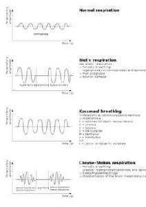 庫斯莫呼吸 庫斯莫呼吸