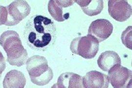 白細胞增多 白細胞增多