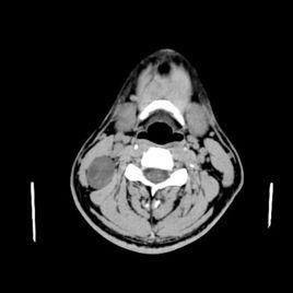 高解析度ct 高解析度ct