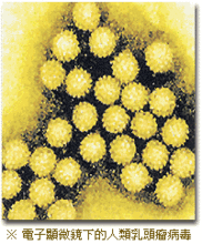 電子顯微鏡下的人類乳頭瘤病毒