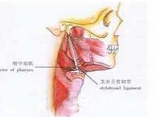 咽肌痙攣