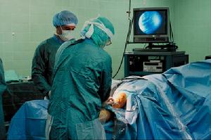 膝關節鏡手術過程