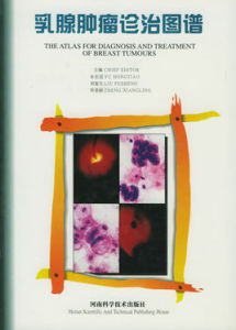 乳腺腫瘤診治圖譜 乳腺腫瘤診治圖譜