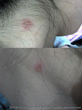 貓癬[動物疾病]