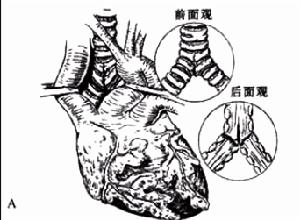 創傷性氣管及主支氣管損傷