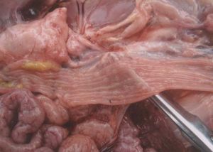 直腸黏膜上有透明樣結節