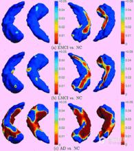 大腦功能網路動態圖譜