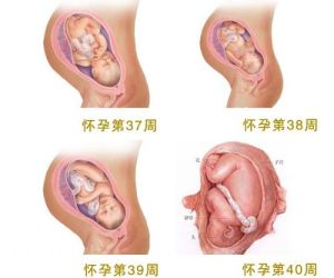 產後子宮收縮