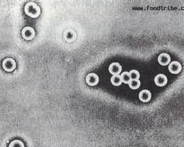 醋酸發酵 醋酸發酵