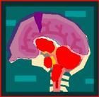 缺氧缺血性腦病 缺氧缺血性腦病