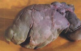 肝片吸蟲病 肝片吸蟲病