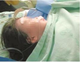 成都女童墜樓奇蹟生還事件