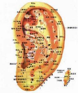 耳穴壓豆法