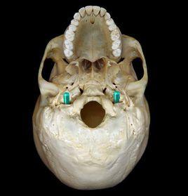 頸靜脈孔 頸靜脈孔