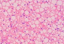 潘氏試驗 潘氏試驗