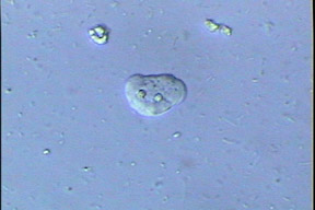 溶組織內阿米巴