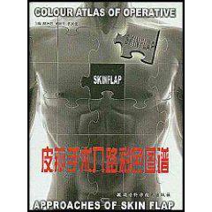 皮瓣手術入路彩色圖譜 皮瓣手術入路彩色圖譜