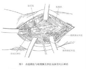 橈管綜合徵 橈管綜合徵