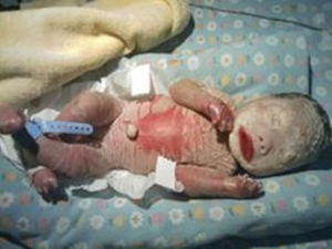 火膠棉嬰兒 火膠棉嬰兒