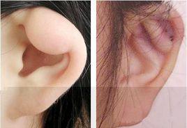 隱耳 隱耳