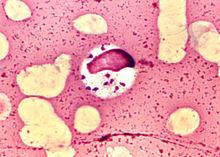 杜氏利什曼原蟲