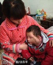 趙子涵[因患眼癌而受關注的話題人物]