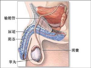 輸精管梗阻