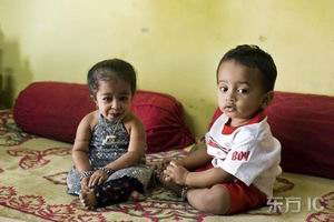 生長激素缺乏性侏儒症