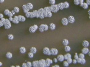 微黃綠鏈黴菌 微黃綠鏈黴菌