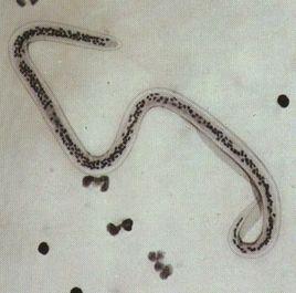 毛首鞭形線蟲