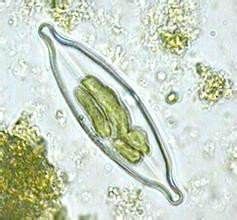 短小舟形藻 短小舟形藻