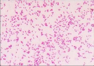 腸病原性大腸埃希桿菌感染 腸病原性大腸埃希桿菌感染