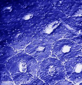 表面黏液細胞 表面黏液細胞