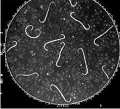 問號鉤端螺旋體 問號鉤端螺旋體