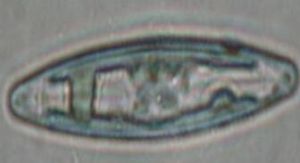 扁圓卵形藻 扁圓卵形藻