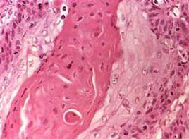 肺外症狀 肺外症狀