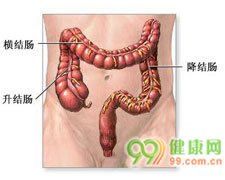 結腸過敏 結腸過敏