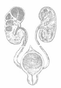 巴氨西林泌尿系統感染