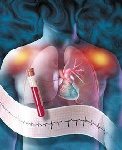 假性心絞痛 假性心絞痛