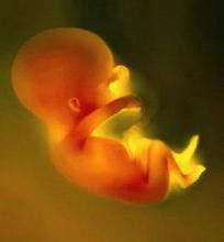 胎兒先天畸形 胎兒先天畸形